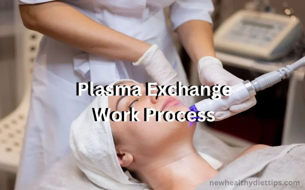 Plasma Exchange Work Process