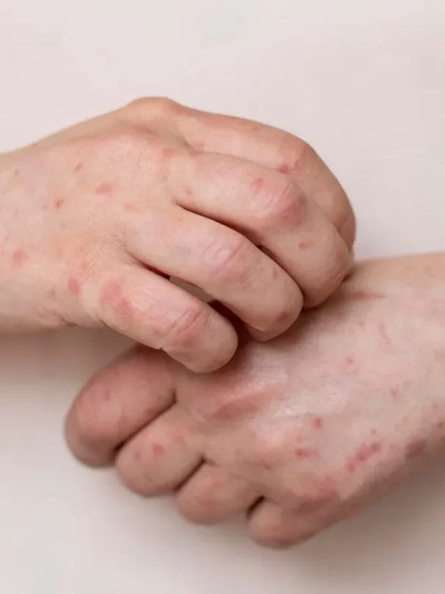 skin allergy persons arm